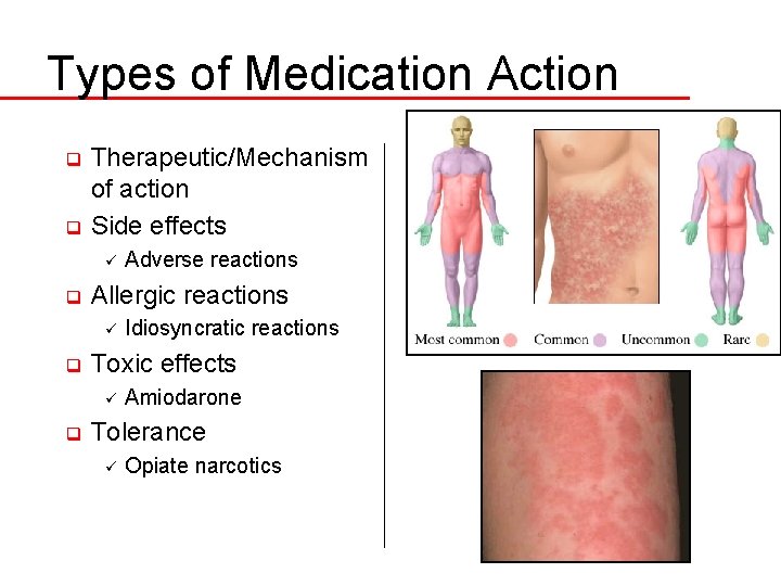 Types of Medication Action Therapeutic/Mechanism of action q Side effects q ü q Allergic
