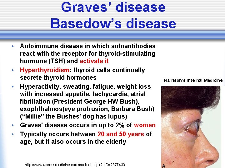 Graves’ disease Basedow’s disease • Autoimmune disease in which autoantibodies react with the receptor