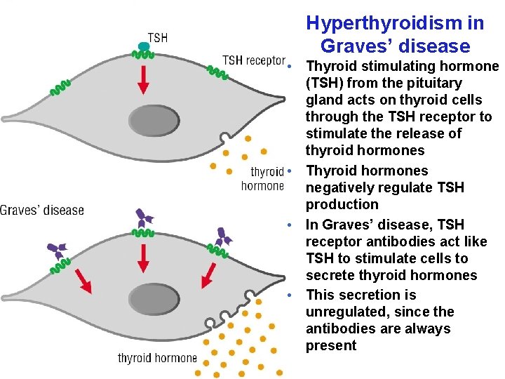 Hyperthyroidism in Graves’ disease • Thyroid stimulating hormone (TSH) from the pituitary gland acts