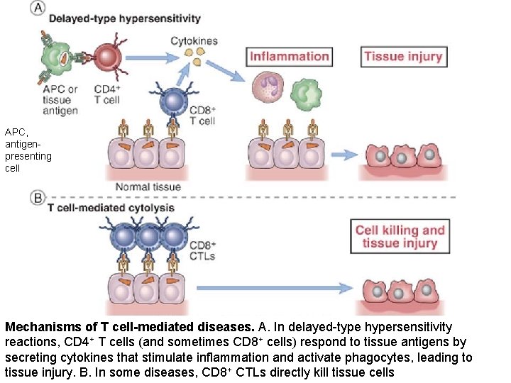 APC, antigenpresenting cell Mechanisms of T cell-mediated diseases. A. In delayed-type hypersensitivity reactions, CD