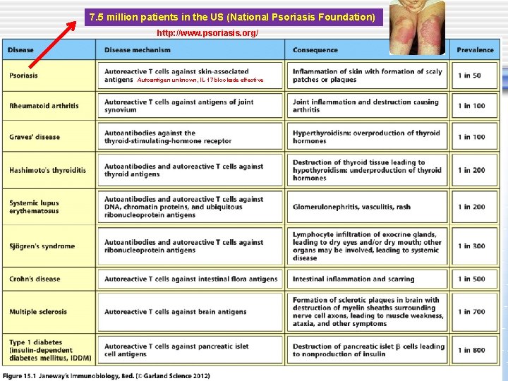 7. 5 million patients in the US (National Psoriasis Foundation) http: //www. psoriasis. org/