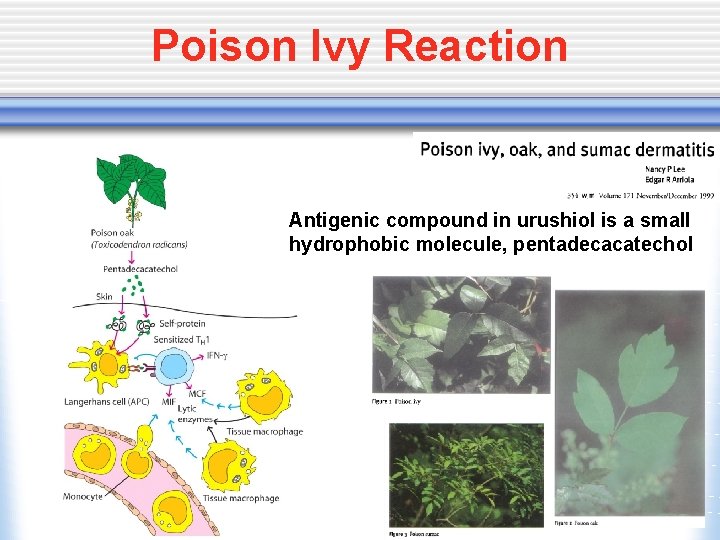 Poison Ivy Reaction Antigenic compound in urushiol is a small hydrophobic molecule, pentadecacatechol 