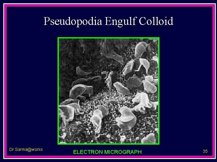 Pseudopodia Engulf Colloid Dr. Sarma@works ELECTRON MICROGRAPH 35 
