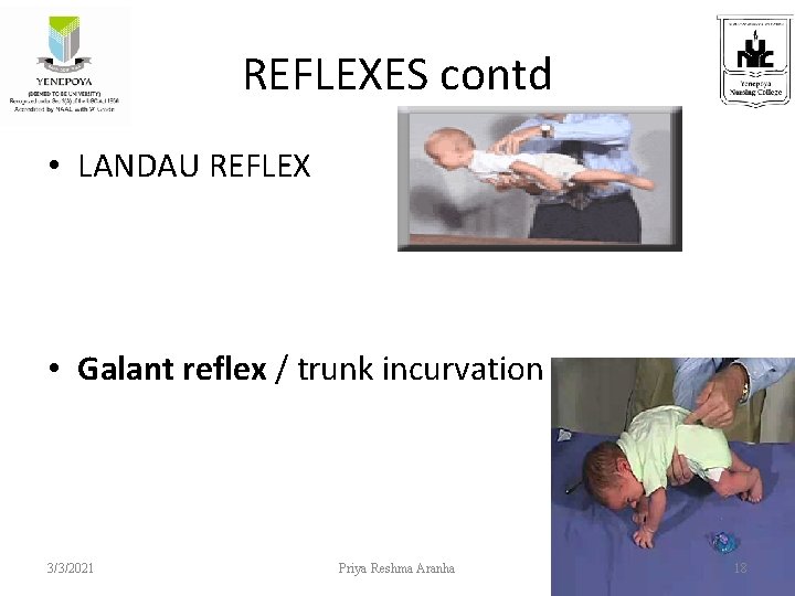 REFLEXES contd • LANDAU REFLEX • Galant reflex / trunk incurvation 3/3/2021 Priya Reshma