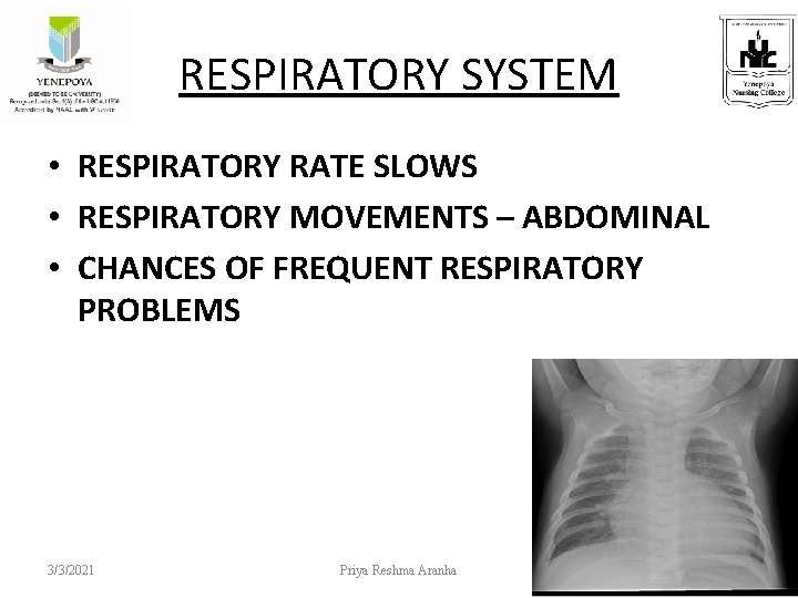 RESPIRATORY SYSTEM • RESPIRATORY RATE SLOWS • RESPIRATORY MOVEMENTS – ABDOMINAL • CHANCES OF