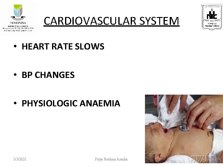 CARDIOVASCULAR SYSTEM • HEART RATE SLOWS • BP CHANGES • PHYSIOLOGIC ANAEMIA 3/3/2021 Priya