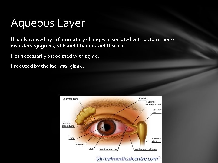 Aqueous Layer Usually caused by inflammatory changes associated with autoimmune disorders Sjogrens, SLE and Aqueous Layer Usually caused by inflammatory changes associated with autoimmune disorders Sjogrens, SLE and