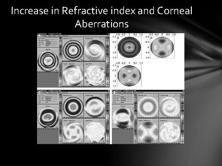 Increase in Refractive index and Corneal Aberrations Increase in Refractive index and Corneal Aberrations