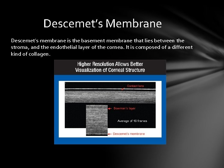 Descemet’s Membrane Descemet's membrane is the basement membrane that lies between the stroma, and Descemet’s Membrane Descemet's membrane is the basement membrane that lies between the stroma, and