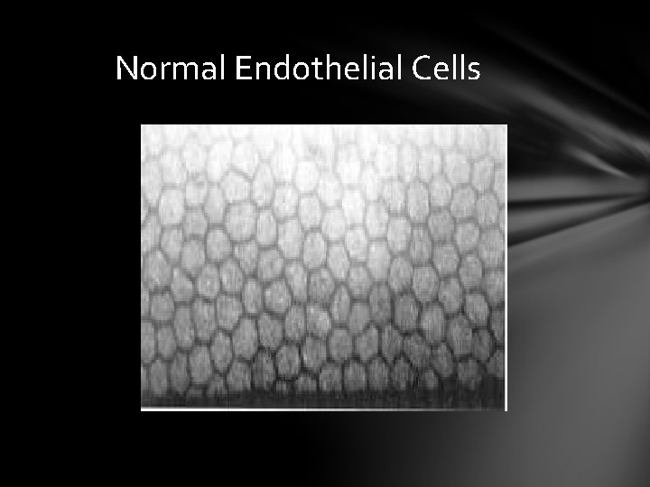 Normal Endothelial Cells Normal Endothelial Cells