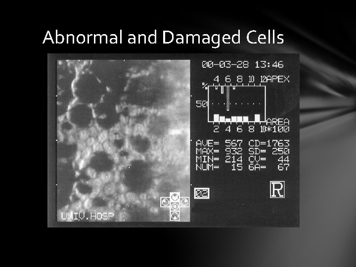 Abnormal and Damaged Cells Abnormal and Damaged Cells