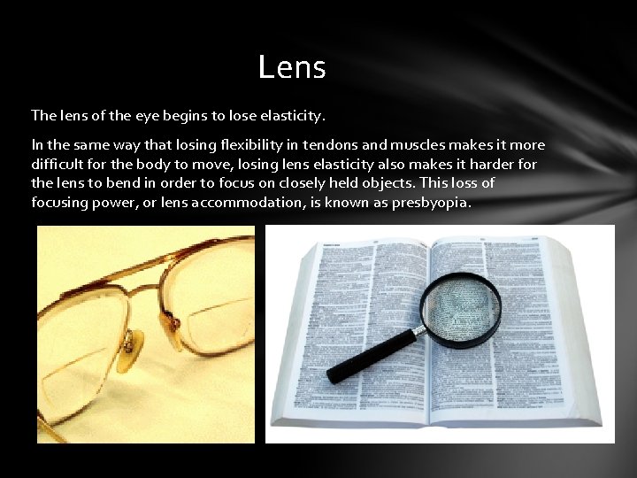 Lens The lens of the eye begins to lose elasticity. In the same way Lens The lens of the eye begins to lose elasticity. In the same way