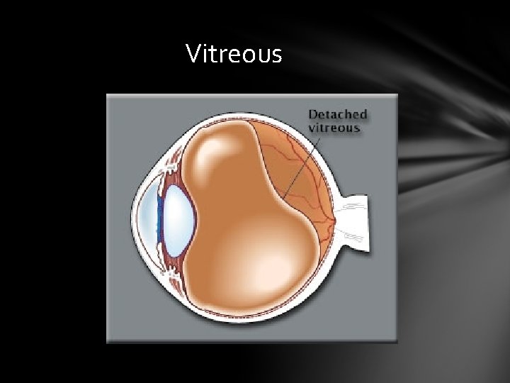 Vitreous Vitreous