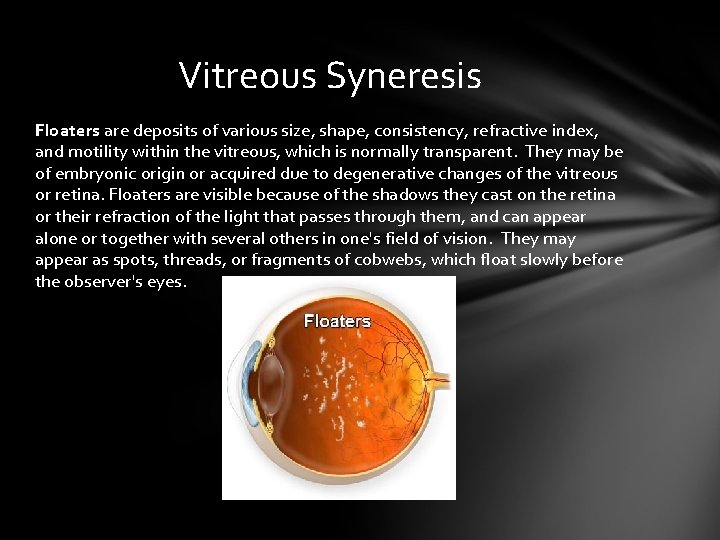 Vitreous Syneresis Floaters are deposits of various size, shape, consistency, refractive index, and motility Vitreous Syneresis Floaters are deposits of various size, shape, consistency, refractive index, and motility