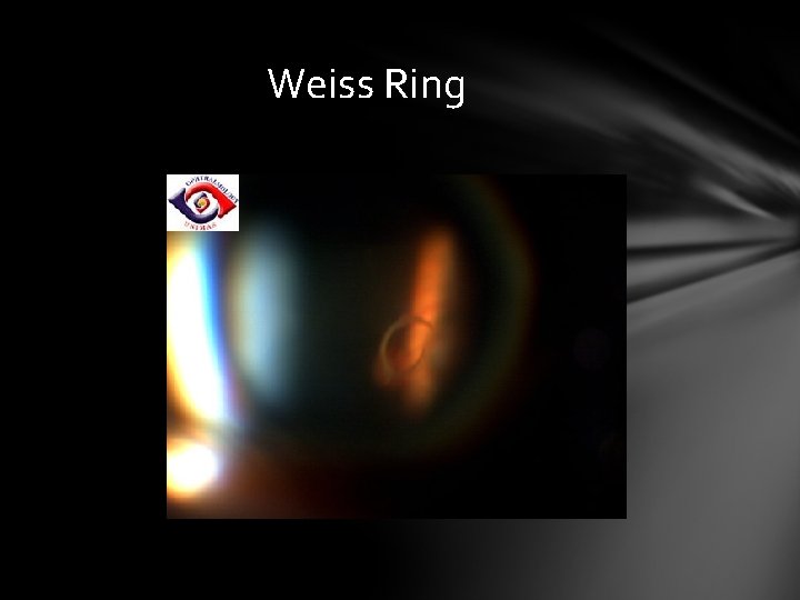Weiss Ring Weiss Ring