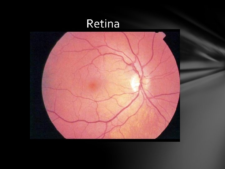 Retina Retina