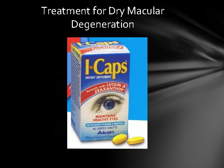 Treatment for Dry Macular Degeneration Treatment for Dry Macular Degeneration