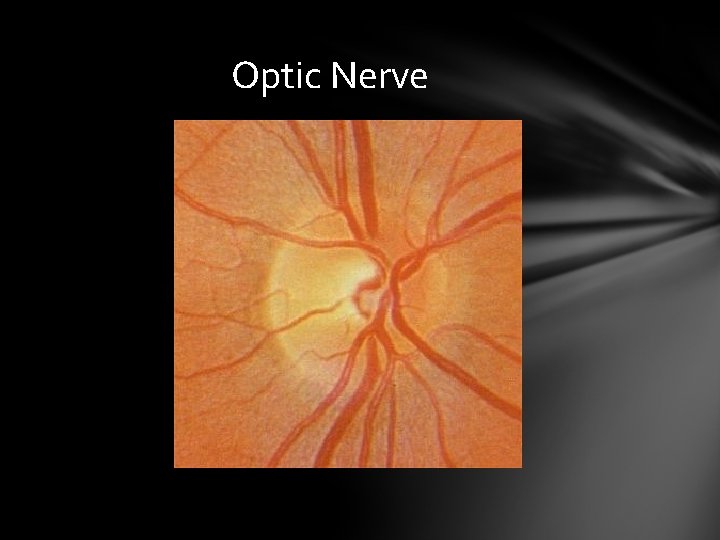 Optic Nerve Optic Nerve