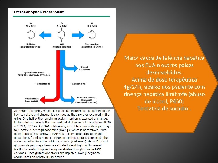 Maior causa de falência hepática nos EUA e outros países desenvolvidos. Acima da dose