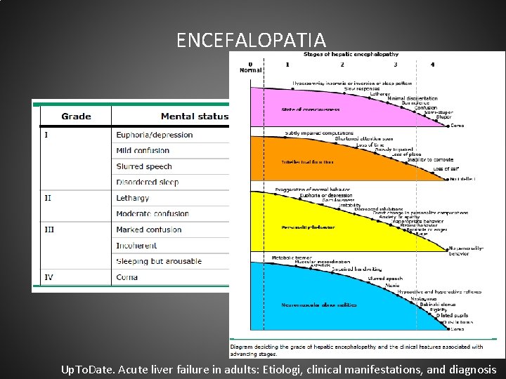 ENCEFALOPATIA Up. To. Date. Acute liver failure in adults: Etiologi, clinical manifestations, and diagnosis