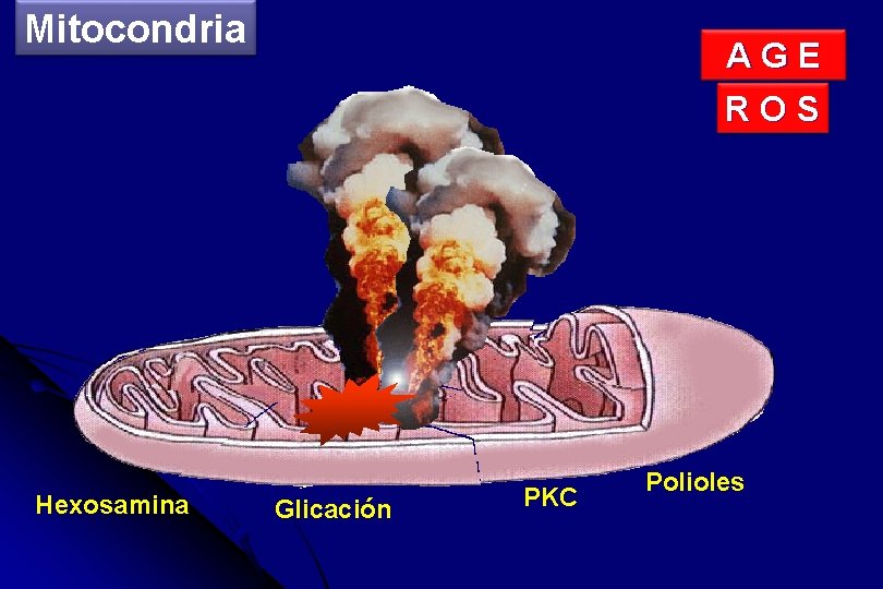 Mitocondria Hexosamina A G E R O S Glicación PKC Polioles 