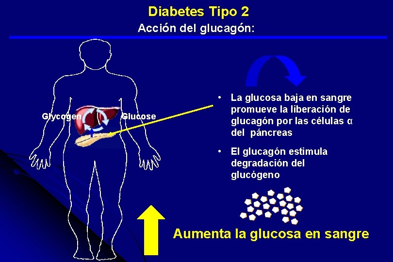  Diabetes Tipo 2 Acción del glucagón: Glycogen Glucose • La glucosa baja en