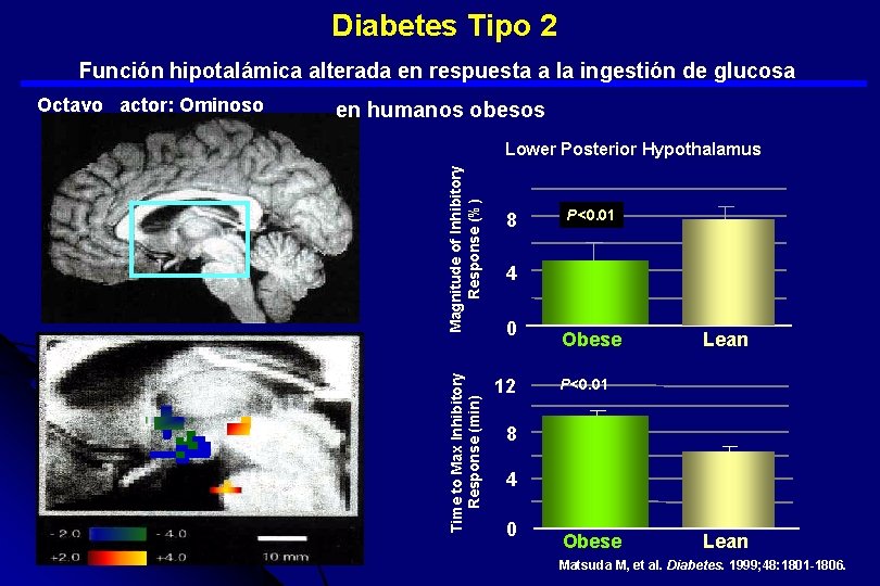  Diabetes Tipo 2 Función hipotalámica alterada en respuesta a la ingestión de glucosa