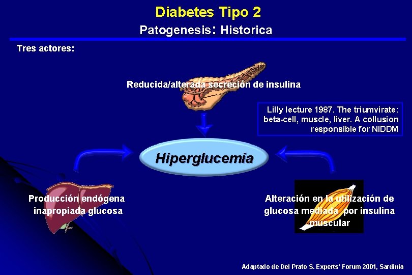  Diabetes Tipo 2 Patogenesis: Historica Tres actores: Reducida/alterada secreción de insulina Lilly lecture