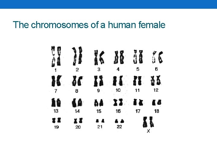 The chromosomes of a human female 