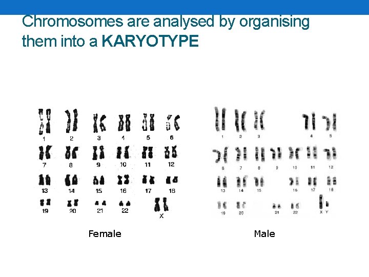 Chromosomes are analysed by organising them into a KARYOTYPE Female Male 