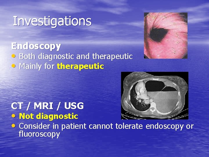 Investigations Endoscopy • Both diagnostic and therapeutic • Mainly for therapeutic CT / MRI