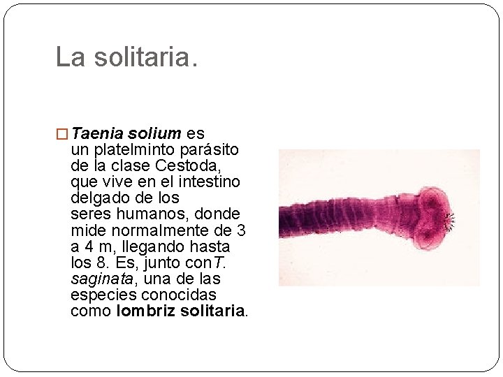 La solitaria. � Taenia solium es un platelminto parásito de la clase Cestoda, que