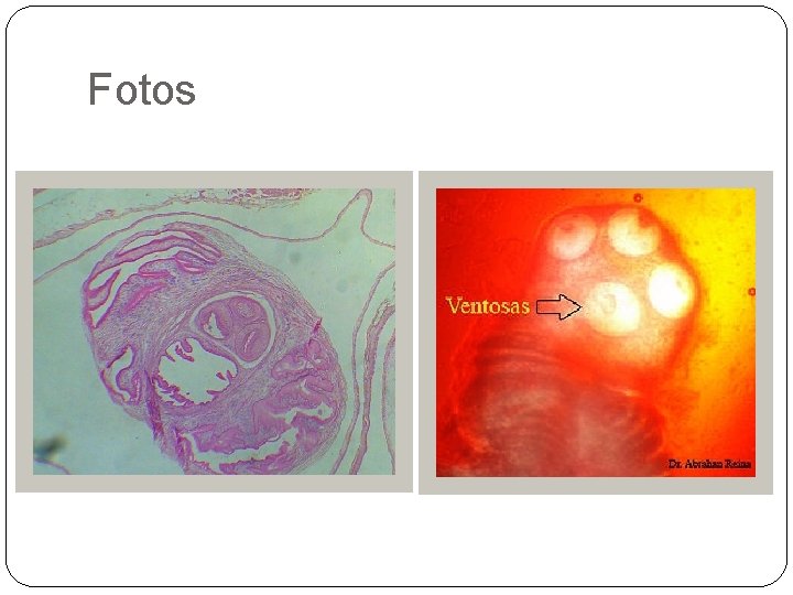 Fotos 