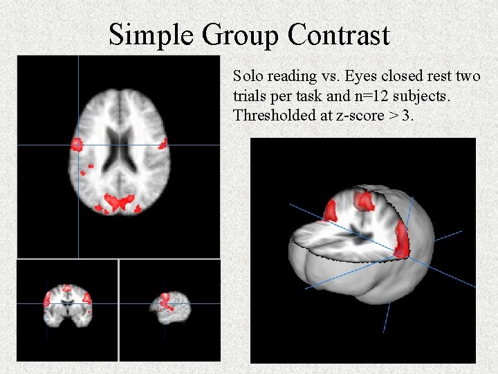 Simple Group Contrast Solo reading vs. Eyes closed rest two trials per task and