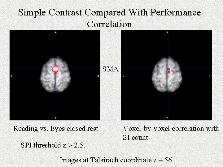Simple Contrast Compared With Performance Correlation SMA Reading vs. Eyes closed rest SPI threshold