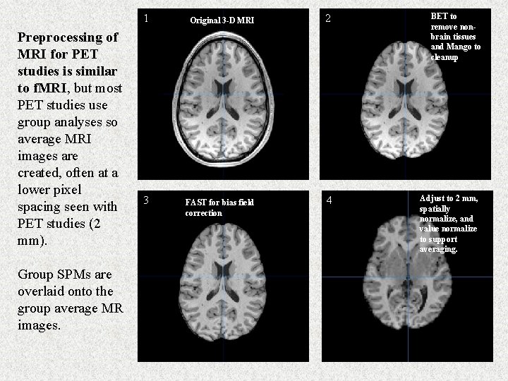 Preprocessing of MRI for PET studies is similar to f. MRI, but most PET