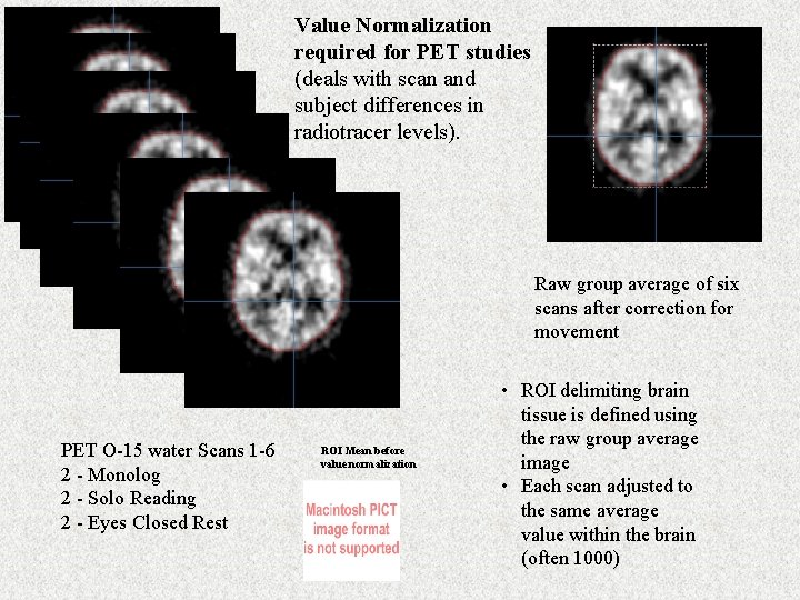 Value Normalization required for PET studies (deals with scan and subject differences in radiotracer