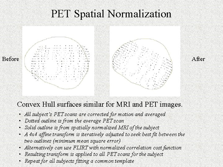 PET Spatial Normalization Before Convex Hull surfaces similar for MRI and PET images. •