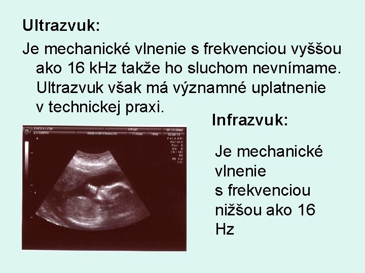 Ultrazvuk: Je mechanické vlnenie s frekvenciou vyššou ako 16 k. Hz takže ho sluchom