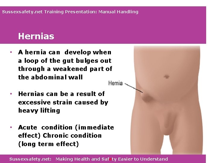 Sussexsafety. net Training Presentation: Manual Handling Hernias • A hernia can develop when a