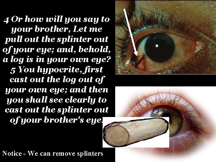 4 Or how will you say to your brother, Let me pull out the 4 Or how will you say to your brother, Let me pull out the