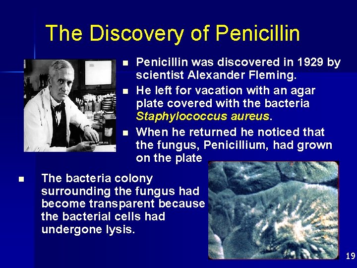 The Discovery of Penicillin n n Penicillin was discovered in 1929 by scientist Alexander