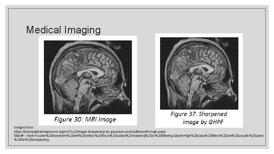 Medical Imaging Images from https: //biomedpharmajournal. org/vol 7 no 2/image-sharpening-by-gaussian-and-butterworth-high-passfilter/#: ~: text=Fourier%20 transform%20 will%20