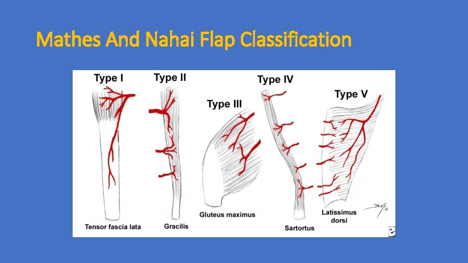 Mathes And Nahai Flap Classification 