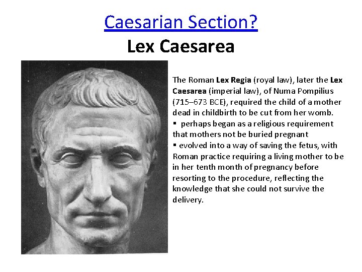 Caesarian Section? Lex Caesarea The Roman Lex Regia (royal law), later the Lex Caesarea