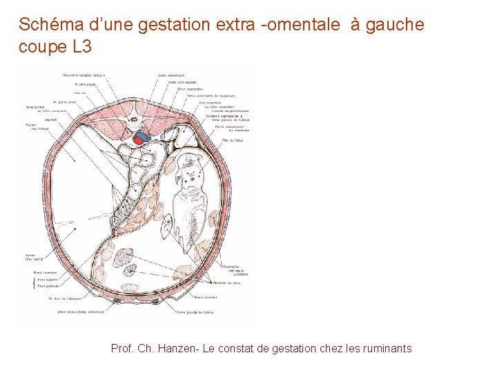 Schéma d’une gestation extra -omentale à gauche coupe L 3 Prof. Ch. Hanzen- Le