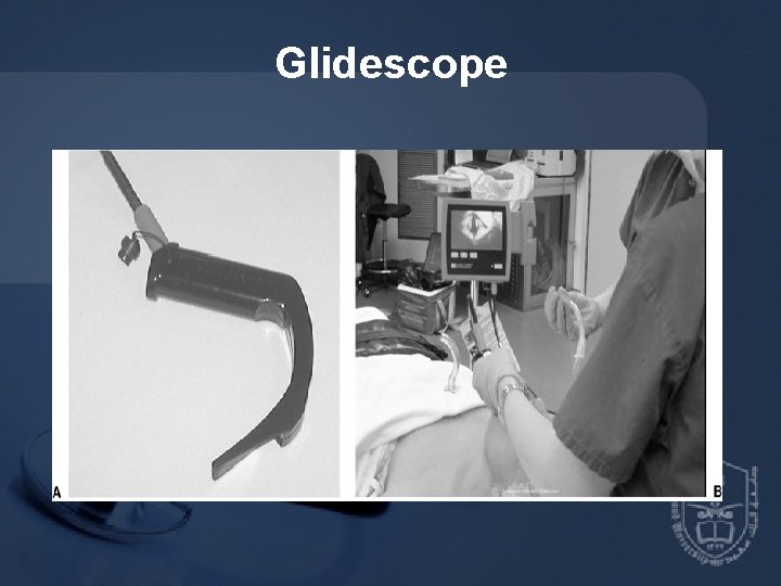 Glidescope 