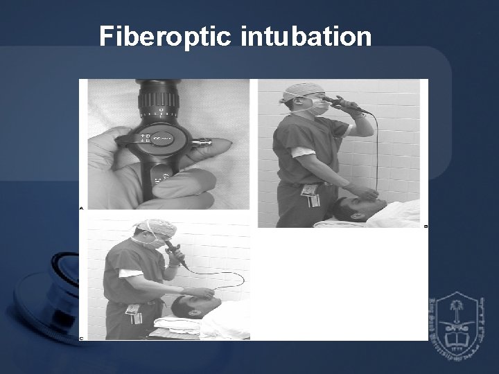 Fiberoptic intubation 