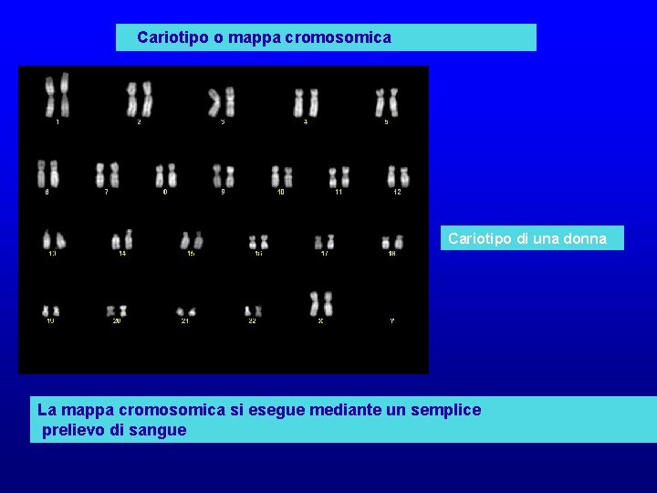 Cariotipo o mappa cromosomica Cariotipo di una donna La mappa cromosomica si esegue mediante