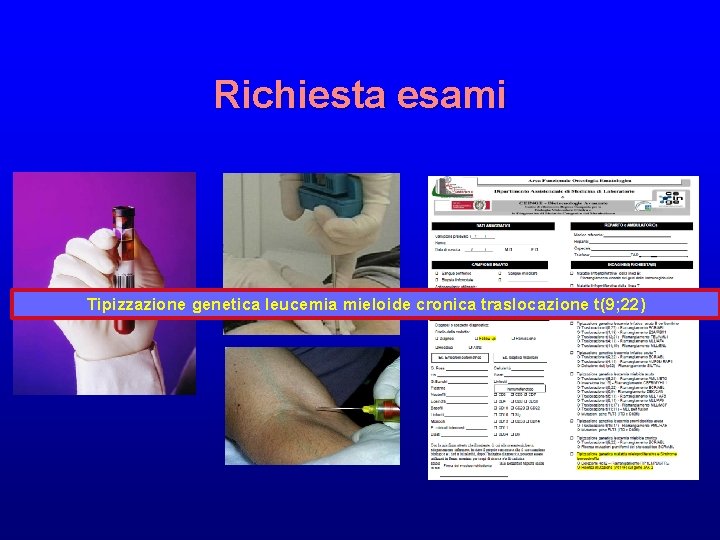 Richiesta esami Tipizzazione genetica leucemia mieloide cronica traslocazione t(9; 22) 